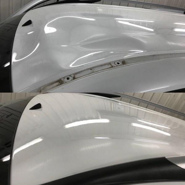 Boyasiz Gocuk Duzeltme Noktasi Denizli Merkez 0 536 270 07 Birmilyonnokta