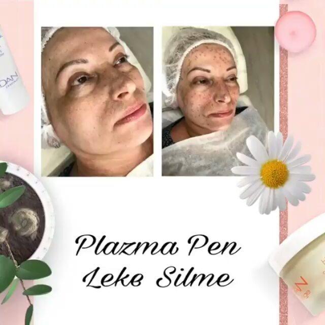 lakia salon konyaalti antalya 0
