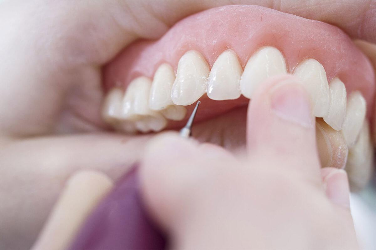 Dental Clinic Iskenderun Dis Hekimi Mehmet Ali Kor Iskenderun Hatay 0 539 307 37 Birmilyonnokta