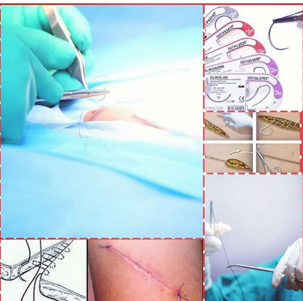Evde Sağlık Hizmetleri Çayırova / Kocaeli 0 (541) 378 37