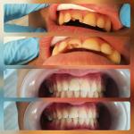 Atakent Dis Klinigi Atakum Samsun 0 553 697 93 Birmilyonnokta